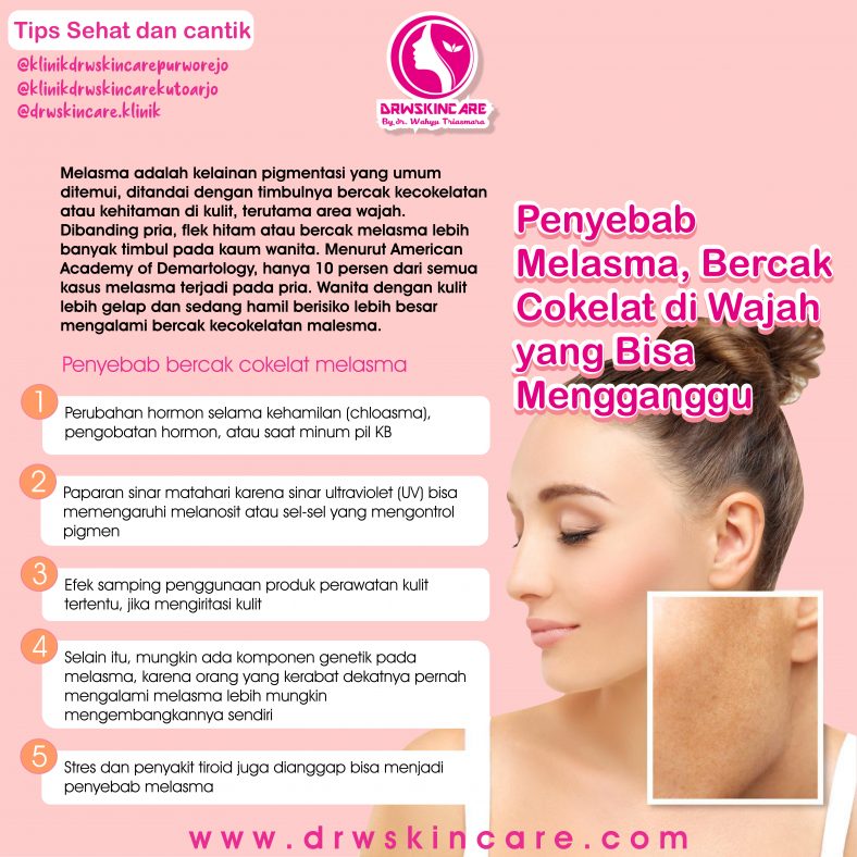 Penyebab Melasma, Bercak Cokelat di Wajah yang Bisa Mengganggu