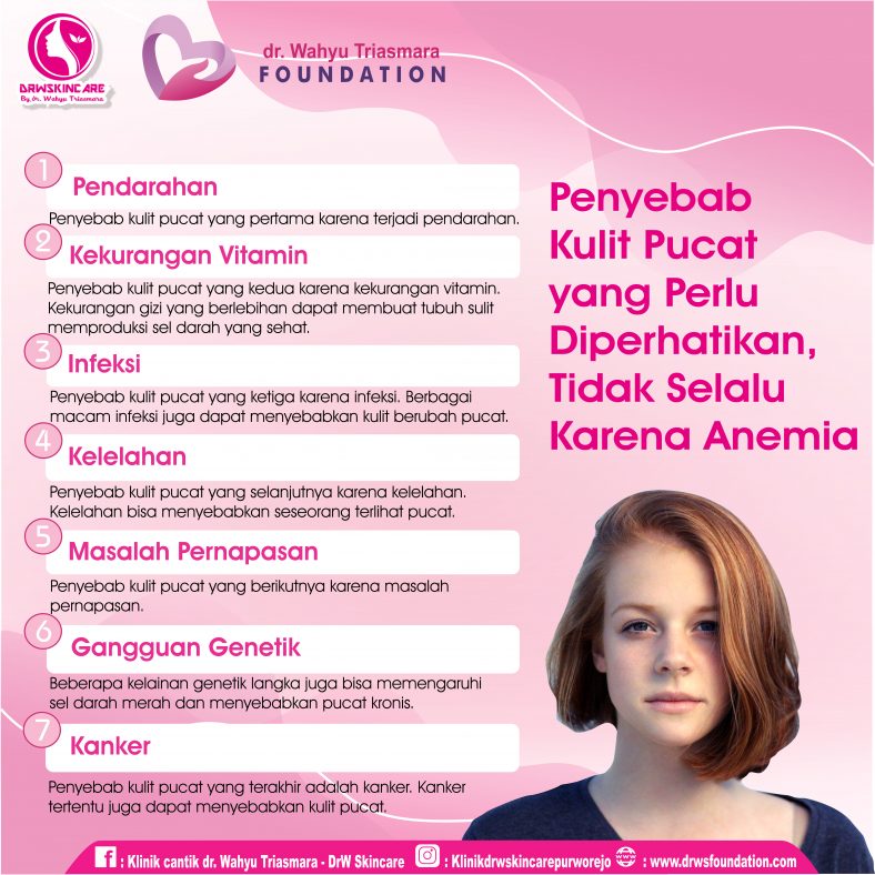 Penyebab Kulit Pucat yang Perlu Diperhatikan, Tidak Selalu Karena Anemia