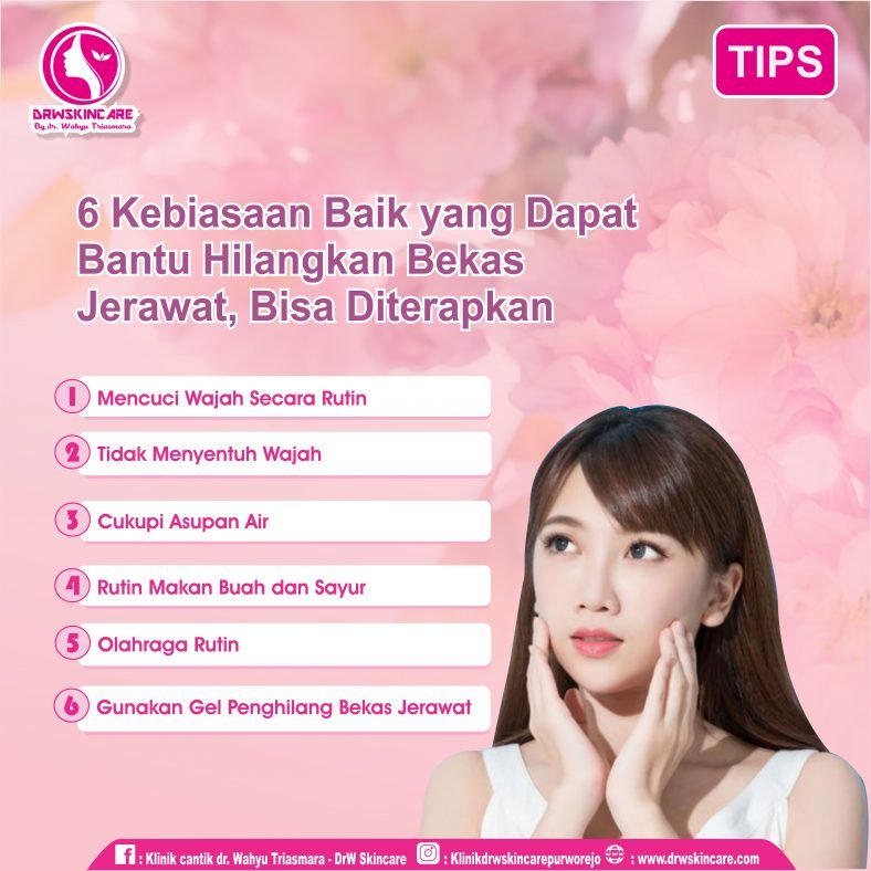 6 Kebiasaan Baik yang Dapat Bantu Hilangkan Bekas Jerawat, Bisa Diterapkan