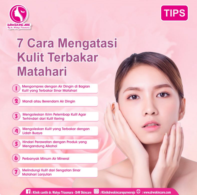 7 Cara Mengatasi Kulit Terbakar Matahari