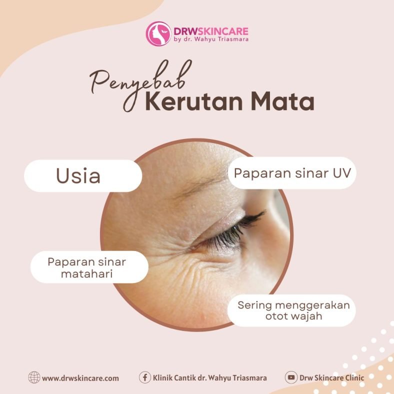 Penyebab Kerutan Mata