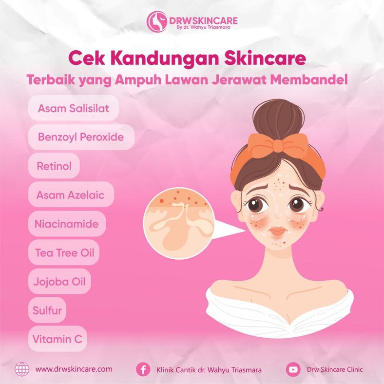 Cek Kandungan Skincare Terbaik yang Ampuh Lawan Jerawat Membandel