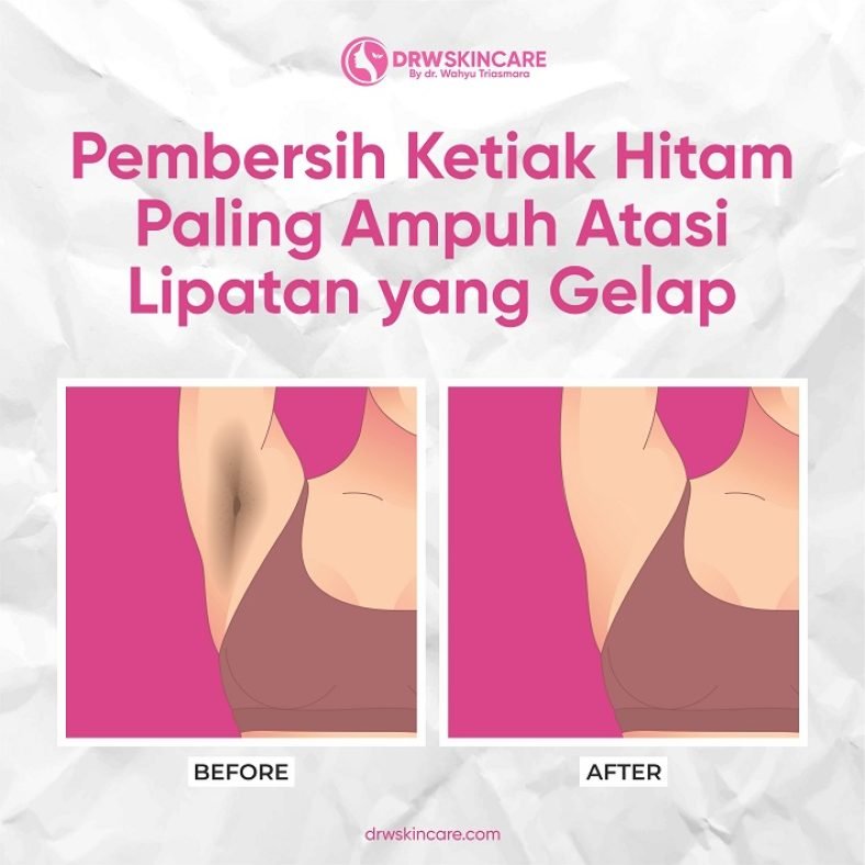 Produk Pembersih Ketiak Hitam Paling Ampuh Atasi Lipatan yang Gelap