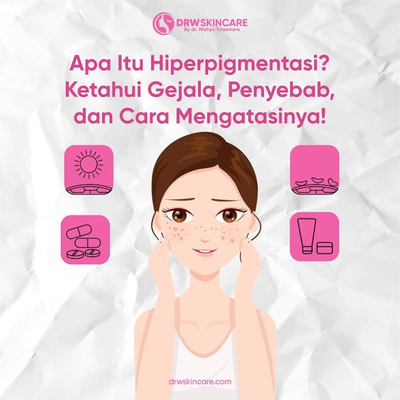 Apa Itu Hiperpigmentasi? Ketahui Gejala, Penyebab, dan Cara Mengatasinya!