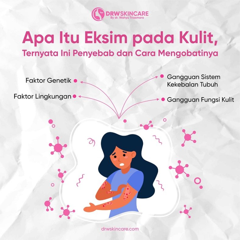 Mengenal Apa Itu Eksim pada Kulit, Ternyata Ini Penyebab dan Cara Mengobatinya
