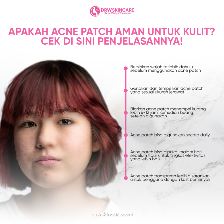 Apakah Acne Patch Aman untuk Kulit? Cek di Sini Penjelasannya!