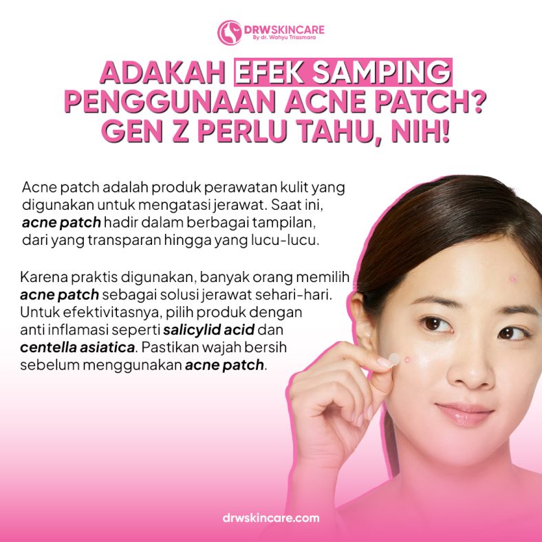 Adakah Efek Samping Penggunaan Acne Patch? Gen Z Perlu Tahu, Nih!