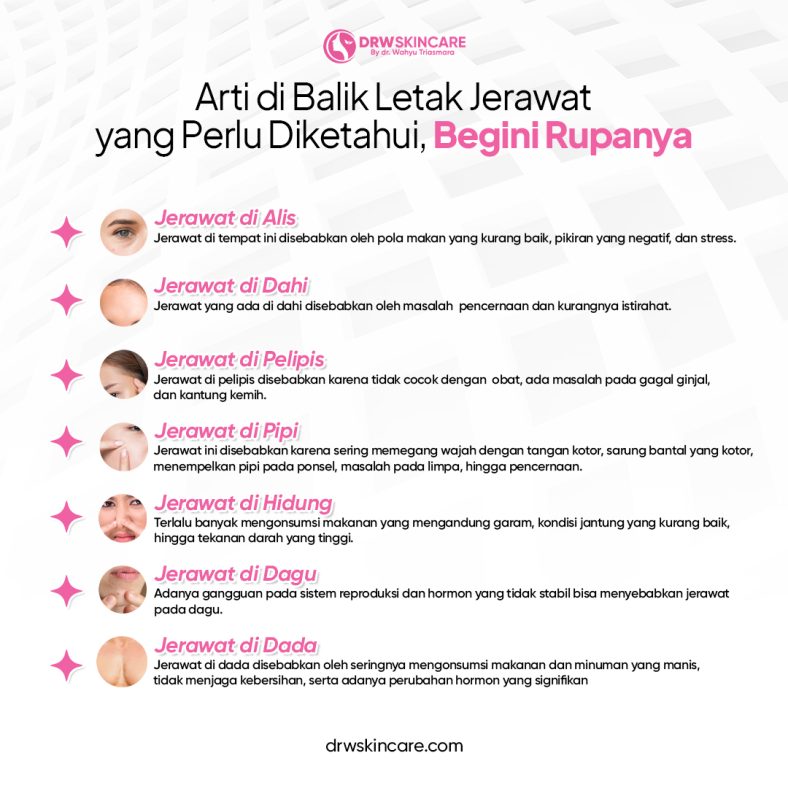 Arti di Balik Letak Jerawat yang Perlu Diketahui, Begini Rupanya!