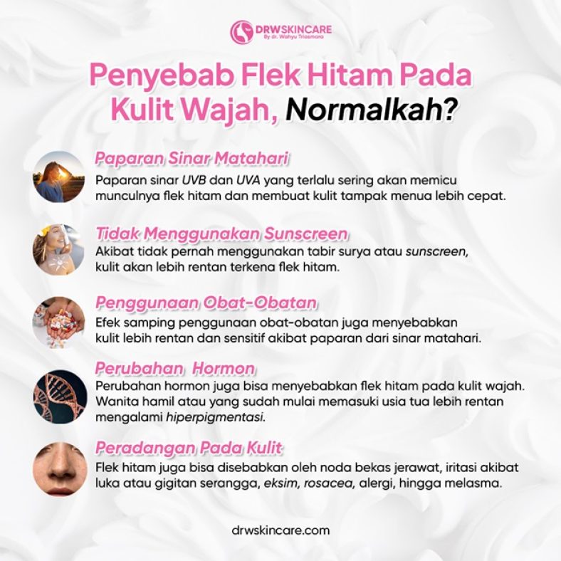 Penyebab Flek Hitam Pada Kulit Wajah, Normalkah?
