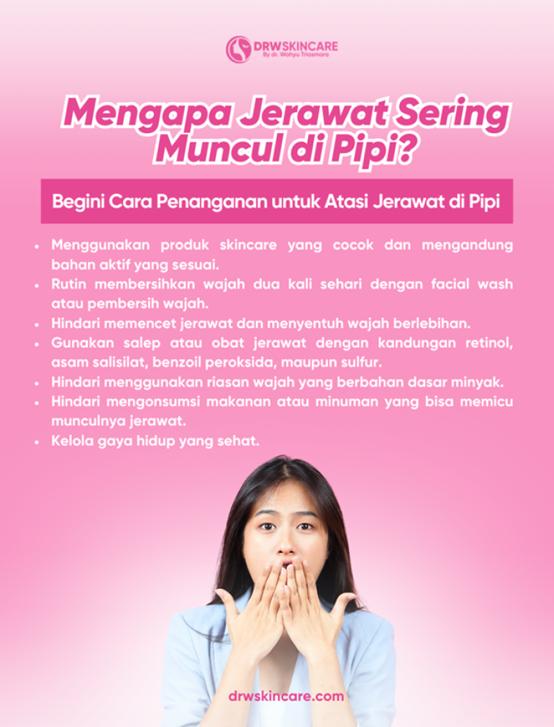 Mengapa Jerawat Sering Muncul di Pipi? Begini Cara Penanganan untuk Atasi Jerawat di Pipi