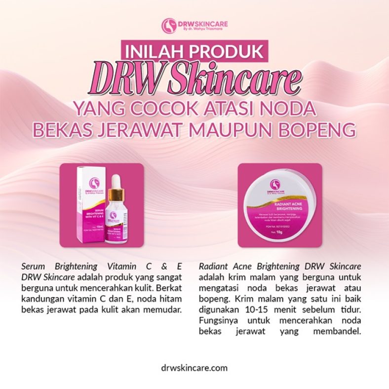 Inilah Produk DRW Skincare yang Cocok Atasi Noda Bekas Jerawat Maupun Bopeng