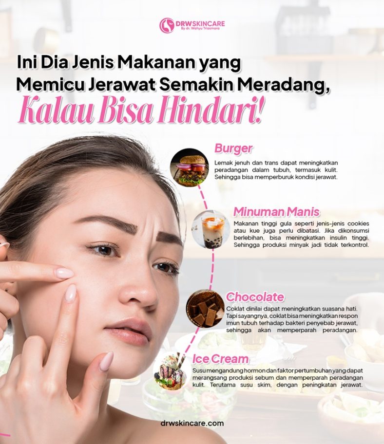 Ini Dia Jenis Makanan yang Memicu Jerawat Semakin Meradang, Kalau Bisa Hindari!
